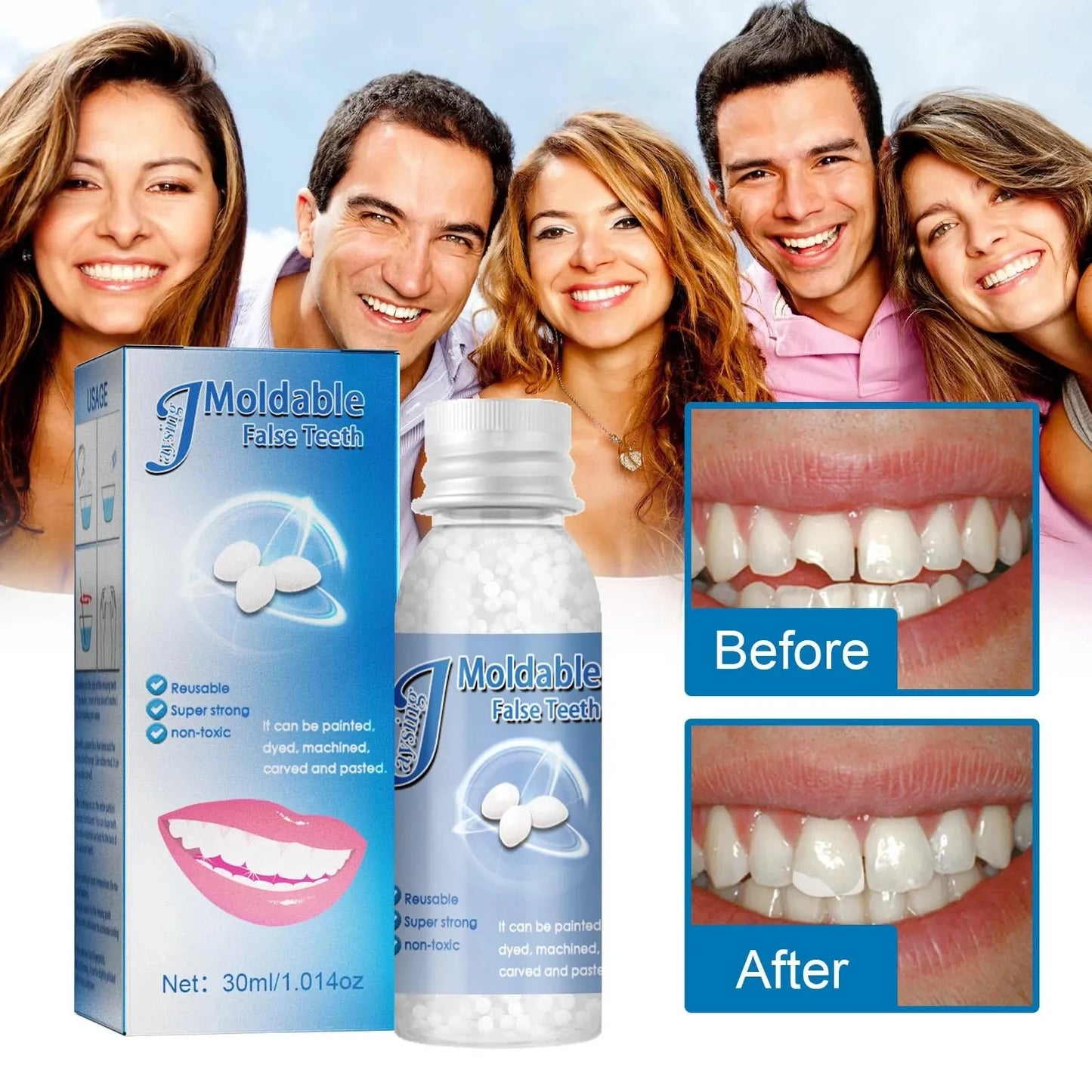Resina Dental Moldeable: Sonríe Sin Miedo